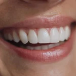 denti bianchi naturalmente